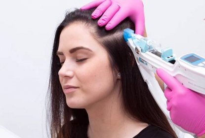 Vlasová mezoterapie s aplikací kmenových buněk + čištění vlasové pokožky