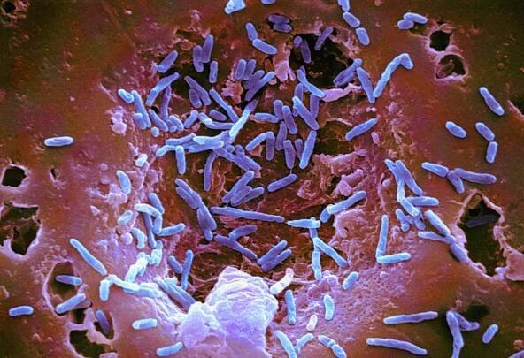 Mycobacterium chelonae bacteria, colored scanning electron micrograph (SEM)