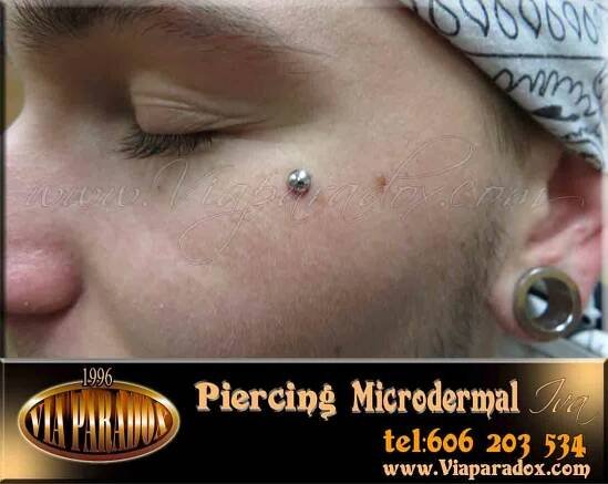 Microdermal - Via Paradox