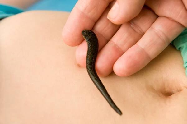 FOTO: Thinkstock