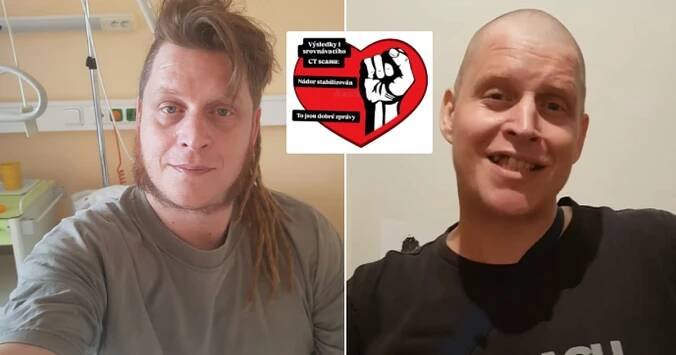 Světoznámý hudebník bojující s rakovinou: Dobré zprávy!