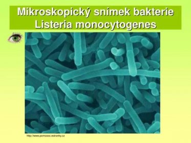 Mikroskopický snímek bakterie Listeria monocytogenes