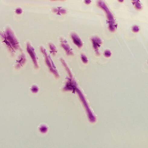 CHROMagar Pasteurella