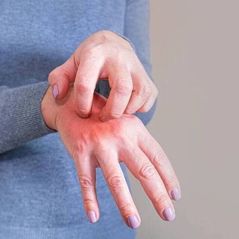Doctors explain infectious skin condition symptoms 'that can take eight weeks to appear'