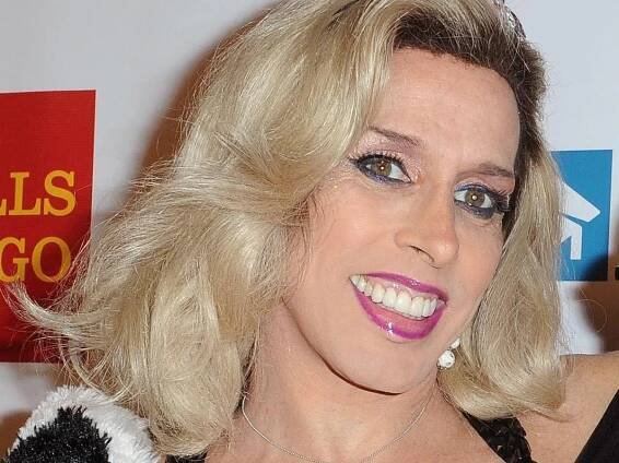 Alexis Arquette's death certificate shows she lived with HIV for 29 years