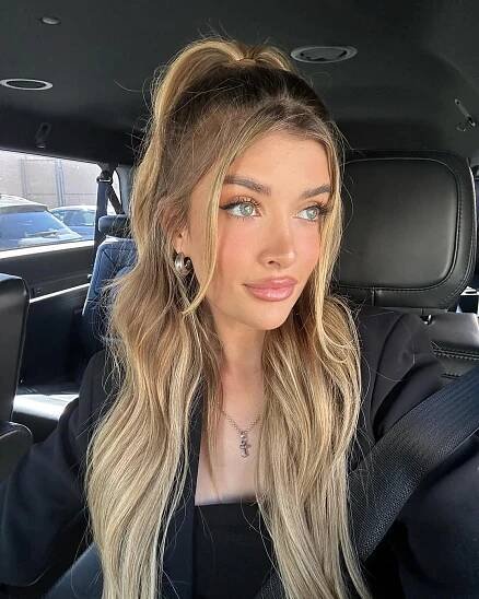 Sami Sheen Lists All of the Cosmetic Surgery Procedures She’s Had Done