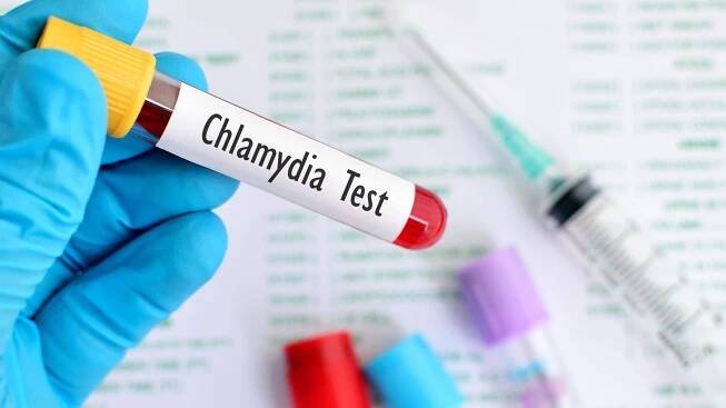 Chlamydia Test
