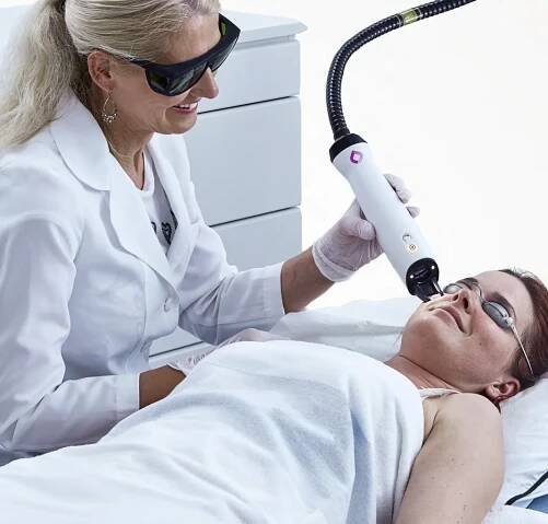 laser resurfacing