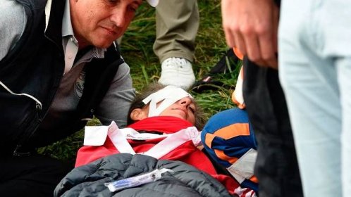 Nehoda na Ryder Cupu: Golfista Koepka trefil míčkem divačku do oka. Oslepla a chce se soudit - Seznam Zprávy