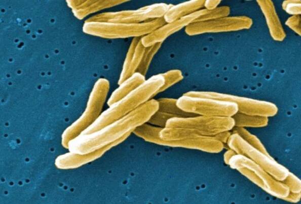 This scanning electron micrograph (SEM) depicts a number of Gram-positive Mycobacterium tuberculosis bacteria. TB bacteria become active, and begin to multiply, if the immune system can't stop them from growing. The bacteria attack the body and destroy tissue. If in the lungs, the bacteria can actually create a hole in the lung tissue.