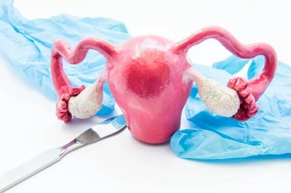 Hysterectomy