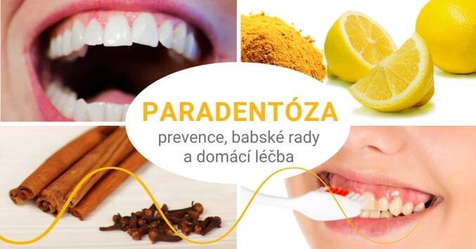 Paradentóza: příznaky, prevence, domácí léčba i babské rady