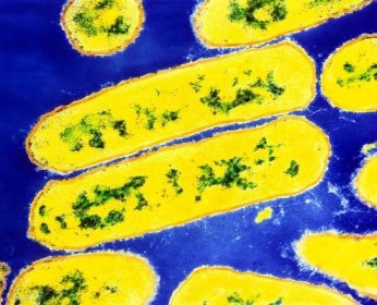 Zákeřná bakterie zabíjí děti. Hemofilus se může projevit i u dospělých