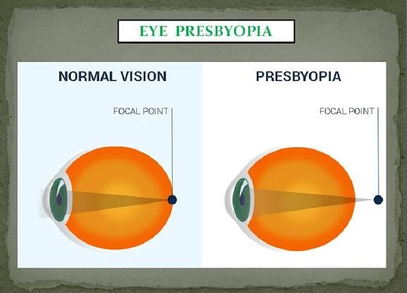 EYE PROBLEMS PACKAGE