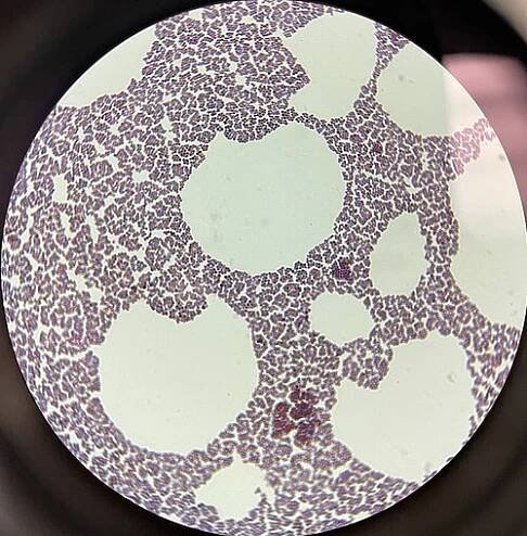 Staphylococcus xylosus - Wikipedia