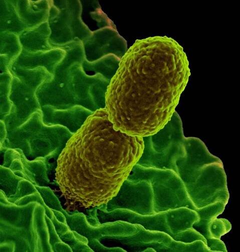 NIH scientists identify nutrient that helps prevent bacterial infection | National Institutes of Health (NIH)