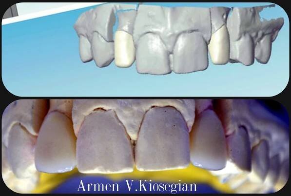 Αισθητική Οδοντιατρική - Dental Clinic 32