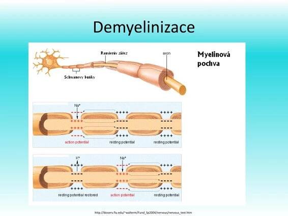 PPT - Patofyziologie nervového systému PowerPoint Presentation, free download - ID:2484095