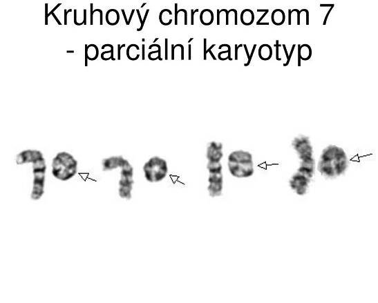 PPT - Strukturní chromozomové aberace PowerPoint Presentation, free download - ID:6120867