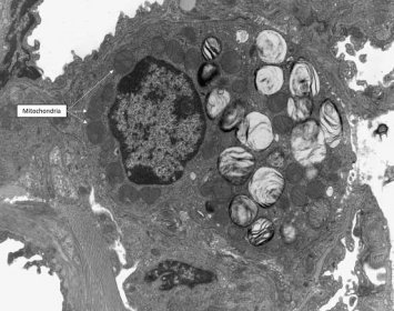 Mitochondria – Veterinary Histology