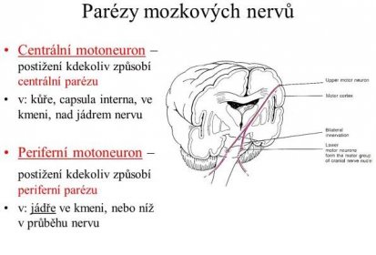 Centrální motoneuron – postižení kdekoliv způsobí centrální parézu. v: kůře, capsula interna, ve kmeni, nad jádrem nervu. Periferní motoneuron – postižení kdekoliv způsobí periferní parézu. v: jádře ve kmeni, nebo níž v průběhu nervu.