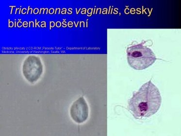 Obrázky převzaty z CD-ROM „Parasite-Tutor – Department of Laboratory Medicine, University of Washington, Seatle, WA.