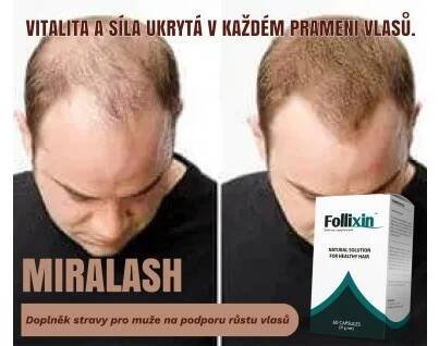 Doplněk stravy pro muže na podporu růstu vlasů