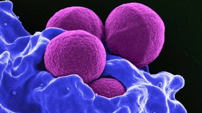 What are bacteria?