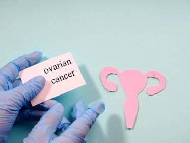 9 Early Warning Signs of Ovarian Cancer You Shouldn’t Ignore