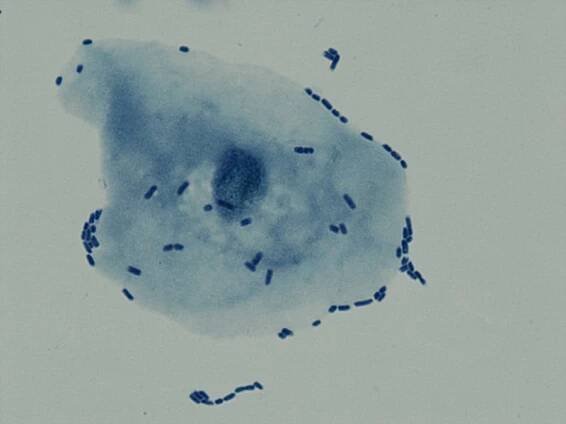 Co na záněty močového měchýře? Zvažte přírodní antibiotika v podobě D-manózy