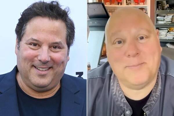 Greg Grunberg Reveals Why He Is Suddenly Bald After Surgery: ‘Millions of People Have This’
