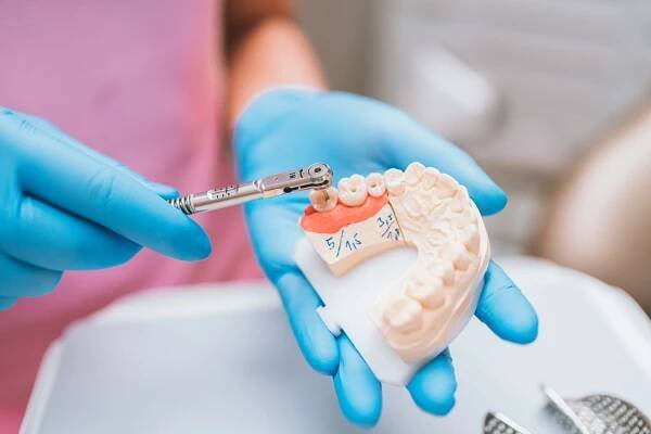 Fixní protéza na implantátech