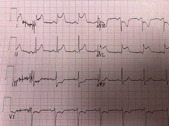 Heart Attack Specialist - New Port Richey, FL: Satish Sivasankaran, MD., MRCP(UK)., FACC., MBA.: Cardiologist: Sunshine