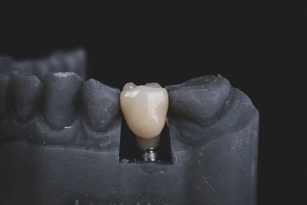 Implantáty :: Ledenta
