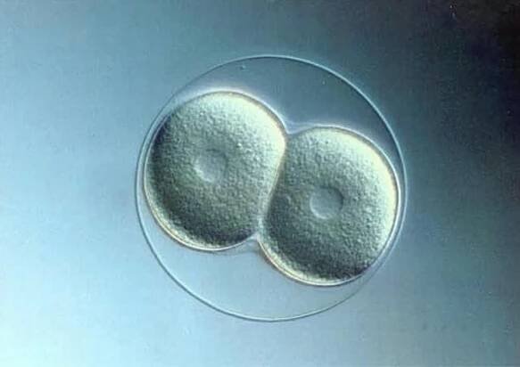 Womb Continuum by Frank Carbone