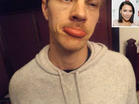 Naya Rivera's Altercation with Ryan Dorsey: Police Release Photos of His Injuries, New Details