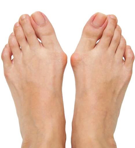 HOUSTON HALLUX RIGIDUS