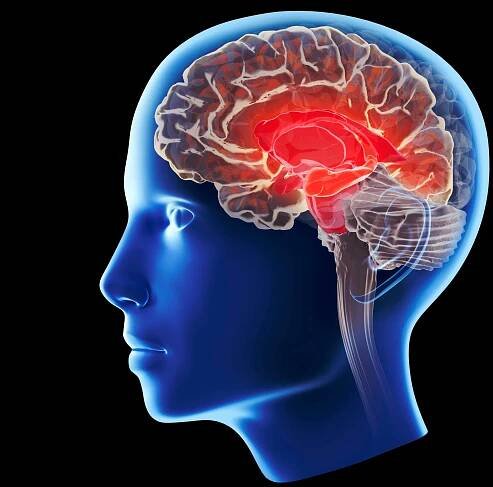 Illustration of Alzheimer's disease affecting the hippocampus.