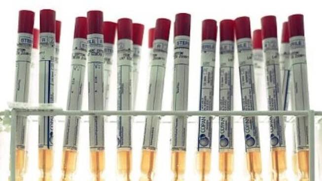 Hackers steal cervical cancer data of almost 500,000 women in Netherlands