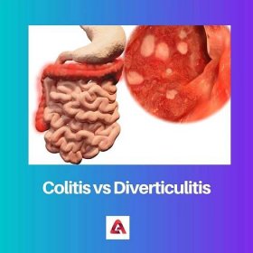 Colitis vs Diverticulitis