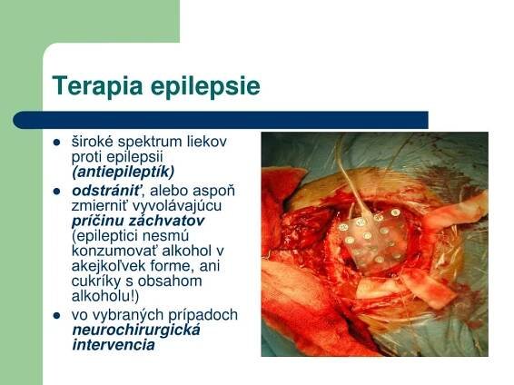 PPT - Neurológia PowerPoint Presentation, free download - ID:951310