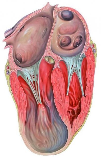Complications of Myocardial Infarction - Cardio Guide