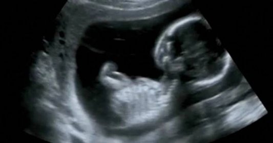 Při ultrazvukovém vyšetření lékaři mysleli, že se přístroj pokazil. Něco takového viděli poprvé v životě