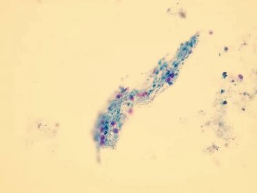 Mikroskopické vyšetření moče | Lékařská fakulta Masarykovy univerzity