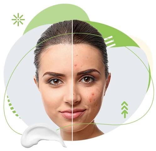 bioderma, krém, akné, pleť