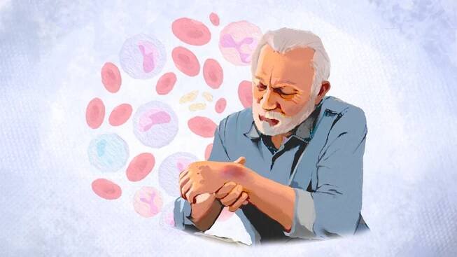 Leukémie: Příznaky, příčiny, léčba a přírodní přístupy