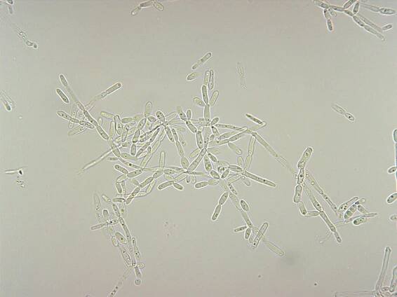Brettanomyces bruxellensis / Dekkara bruxellensis • BiosistoStandard