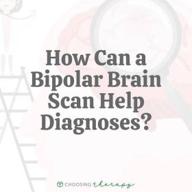 Can a Bipolar Brain Scan Help in Diagnosis?