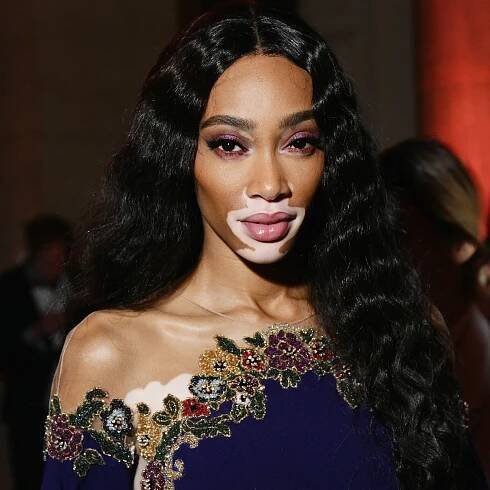 Winnie Harlow Makes History as Sports Illustrated’s First Swimsuit Model With Vitiligo