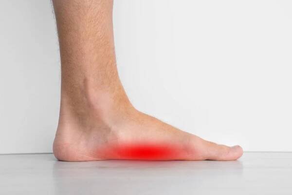 What Causes Flat Feet?